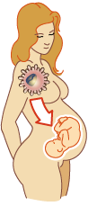 3) Transmission pendant la grossesse, l’accouchement ou l’allaitement